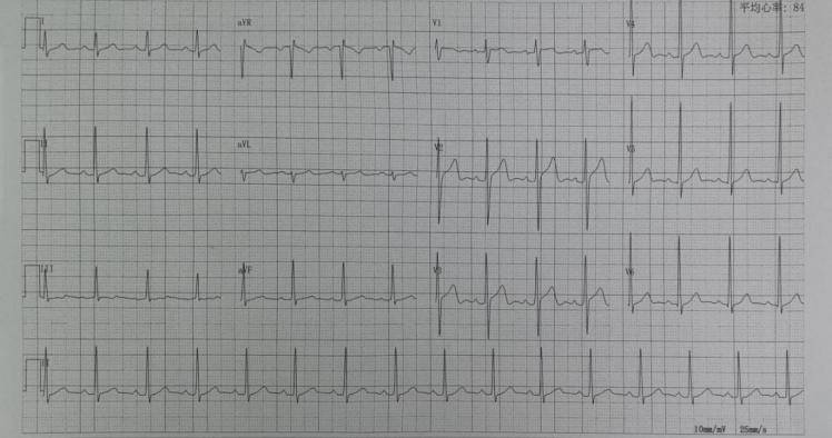 【动态】首都儿童医学中心心血管内科助力篮球少年重返赛场
